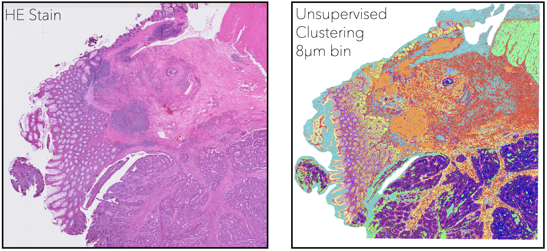 Single-cell resolution tissue architecture generated using spatial transcriptomics assay developed in our prior work